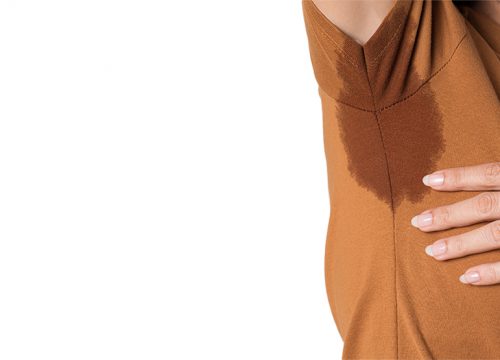 Woman dealing with hyperhidrosis